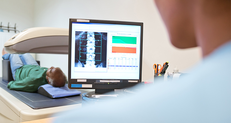 osteoporosis screening from syracuse orthopedic specialists