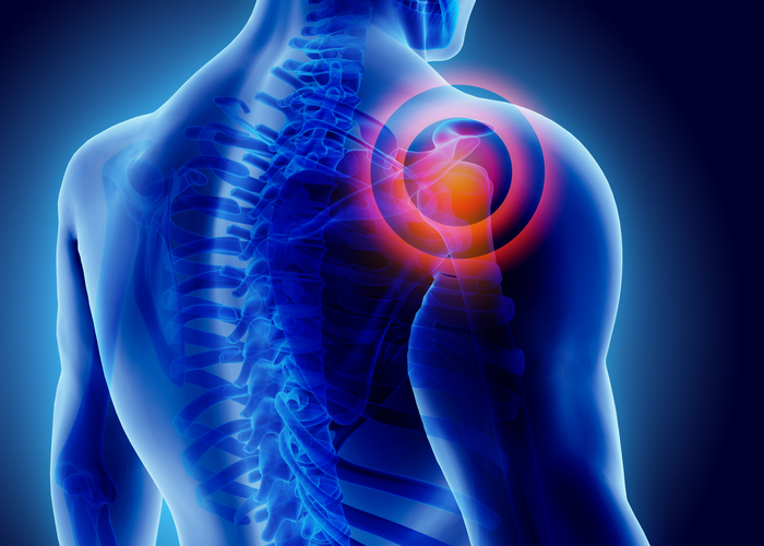 Shoulder Pain Illustration