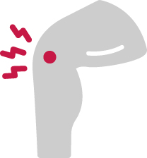 joint replacement from sos syracuse orthopedic specialists graphic for knee pain