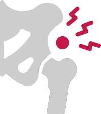 joint replacement from sos syracuse orthopedic specialists graphic for hip pain