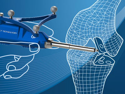 Robotic Computer Assisted Surgery near syracuse ny from sos