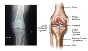 Knee Pain Healthy Knee from SOS