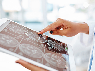 Nuclear Medicine From Syracuse Orthopedic Specialists