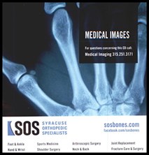 MRI medical image taken by Syracuse Orthopedic Specialists